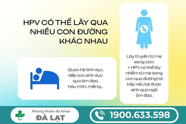 Hình ảnh minh họa